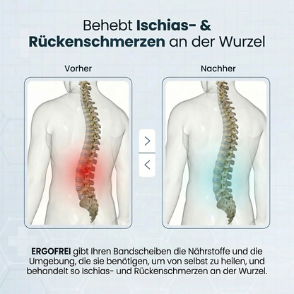 Ergofrei 'Elite Fusion' Gürtel